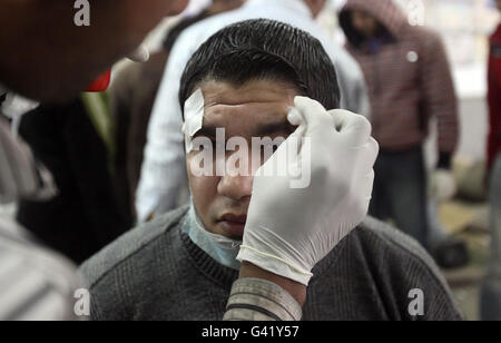 A boy is treated at a makeshift hospital in a mosque off Tahrir Square in Cairo, Egypt, as mass protests against the three-decade rule of President Hosni Mubarak continue across the country. Stock Photo