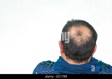 Mature yang man, seen from behind, in the head, begins to lose hair, he begins to be old. Stock Photo