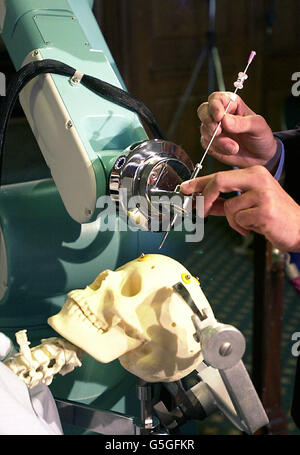 A biopsy probe being inserted into a model skull by a robot capable of performing the most complex brain surgery, which was unveiled by scientists in London. The PathFinder robot will transform the field of neurosurgery and will one day replace the work of human surgeons, its makers claim. The revolutionary machine, the first of its kind in the world, will be used on patients who have suffered brain trauma or who have disorders such as Parkinson's disease. Stock Photo