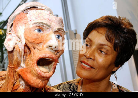 Health visitor Eulinda Clarke-Akalanne, 60, from Somerset who has decided to become a body donor, picutred alongside a plastinate at the Body World's Exhibition at the Atlantis Gallery in Brick Lane, east London. *...A group of donors from around the country travelled to the gathering in London to come face to face with Professor Gunther von Hagens, the creator of the anatomical, show Body Worlds. Stock Photo