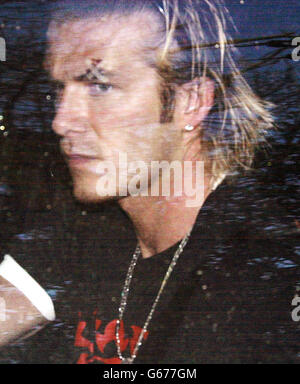 Manchester United footballer David Beckham leaves his home in Cheshire, with a sticking plaster over his left eye. * The Sun reported Beckham required stitches after being accidentally struck by a boot kicked by Sir Alex Ferguson as he vented his fury in the aftermath of Saturday's 2-0 FA Cup defeat by Arsenal at Old Trafford. There is no suggestion that Ferguson meant to hurt Beckham. Stock Photo