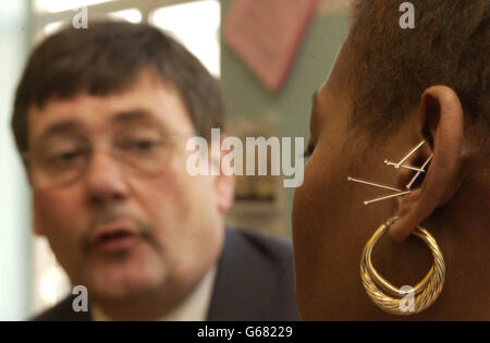 Home Office Minister Bob Ainsworth witnesses an acupuncture treatment at a drugs help centre in West London at a drugs help centre in Ladbroke Grove, west London, *..where he announced thirty seven communites will get funding for specially tailored services to help existing addicts and to prevent youngsters from taking the class A drug 'crack.' The target areas include London, Manchester and Bristol. Stock Photo