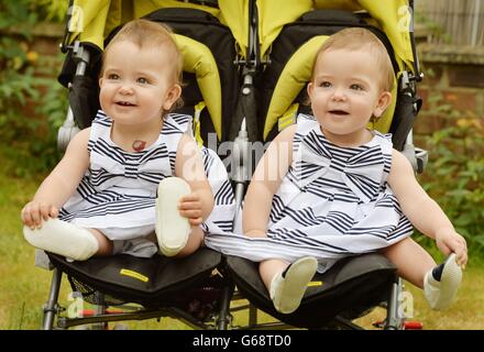 Separated twins mark first birthday Stock Photo