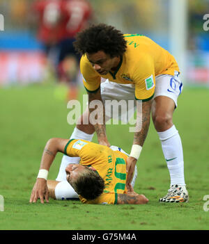 Brazil’s Neymar lies on the pitch with his face bleeding after a rough ...