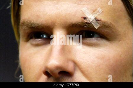 A plaster is visible over the injured left eyebrow of Manchester United mid-fielder David Beckham, during the team line-up, before kick-off in the UEFA Champions League group D match against Juventus at Old Trafford, Manchester. Stock Photo