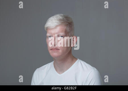 Portrait of albino man against gray background Stock Photo