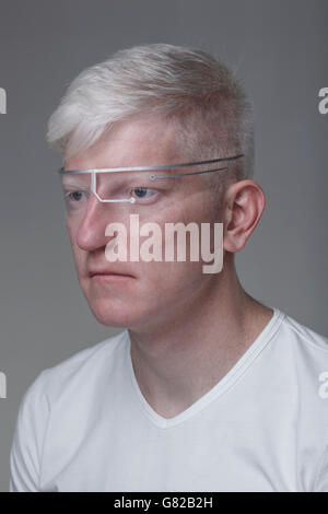 Close-up of albino man wearing protective eyewear against gray background Stock Photo
