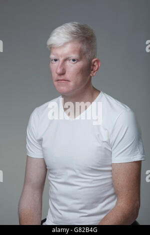 Portrait of young albino man sitting against gray background Stock Photo