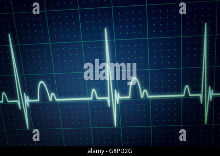 heart monitor machine flatline