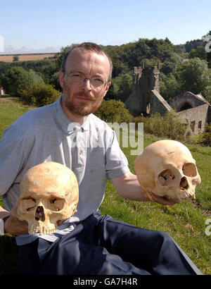Simon Mays the English Heritage Skeletal Biologist with a 13th Century skull (left) and a 11th Century skull found at the Wharram Percy deserted village (seen in background) that has revealed a puzzling shift in skull shapes of humans between those centuries. Stock Photo