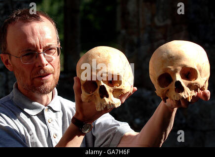 Simon Mays, the English Heritage Skeletal Biologist stands in the ruins of Wharram Percy a deserted village, with a 13th Century skull (left) and a 11th Century skull found in the village, the skulls have revealed a puzzling shift in skull shapes of humans between those centuries. Stock Photo