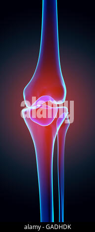 Knee painful - skeleton x-ray, 3D Illustration medical concept. Stock Photo