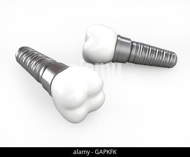 3D illustration of teeth implant on white background, dental concept. Stock Photo