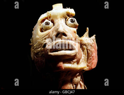 A dissection which forms part of Bodies the Exhibition, which has opened its doors at the Ambassador Theatre in Dublin. Stock Photo