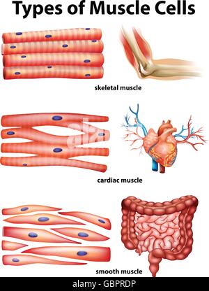 Cancer cells. illustration showing cancer disease development. Healthy ...