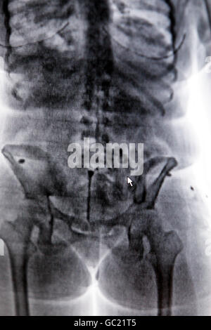 PICTURE POSED BY MODEL X-ray of person caught smuggling drugs, indicated by cursor, at Birmingham International airport. Stock Photo