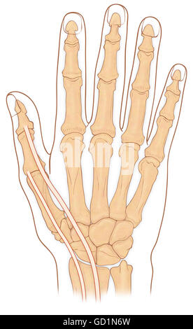 Normal anterior view of hand showing the anatomical snuff box Stock Photo