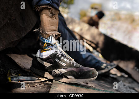 A young Honduran immigrant, having his leg amputated, waits near the railroad track in Lechería station, Mexico City, Mexico. Stock Photo