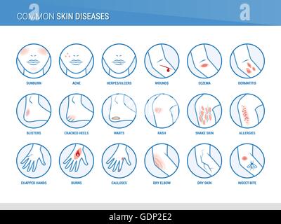 Skin diseases icons set and body parts, healthcare and prevention Stock Vector