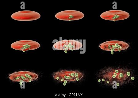Computer illustration showing different stages of release of malaria merozoites from a red blood cell. Malaria is caused by Plasmodium sp. parasitic protozoans transmitted by female Anopheles sp. mosquitos. When the mosquito bites a person, sporozoites in Stock Photo