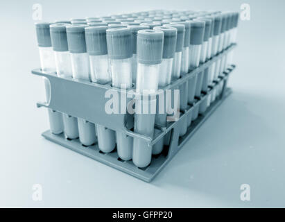 test tubes with blood on a tray Stock Photo