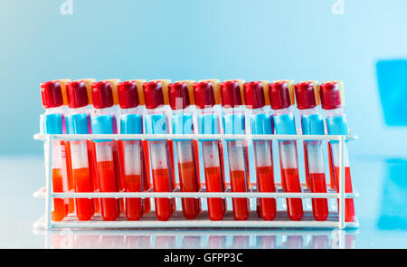 test tubes with blood on a tray Stock Photo