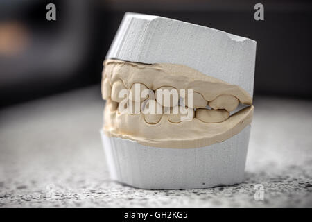 Dental casting gypsum model plaster cast stomatologic human jaws prosthetic laboratory Stock Photo