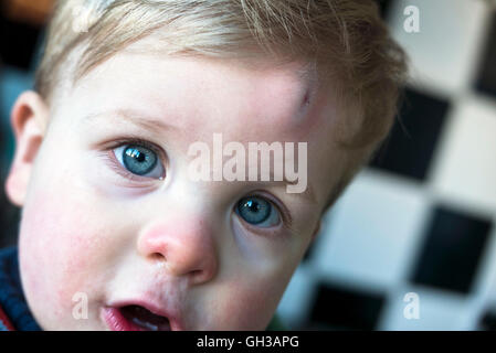 Young boy with head injury Stock Photo