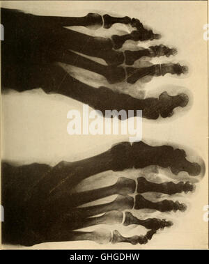 Geriatrics - the diseases of old age and their treatment, including ...