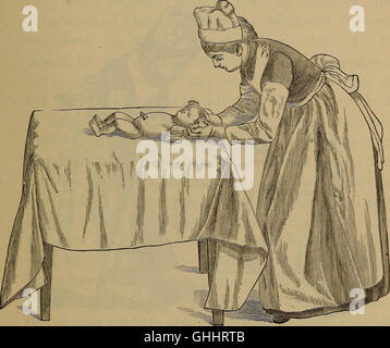 A handbook of obstetrical nursing for nurses, students, and mothers . llen,  immediately afternursing.* For any nipple shield to work perfectly it  mustQual£iesoffit tightly, hence an entire rubber shield is not  soshield-good