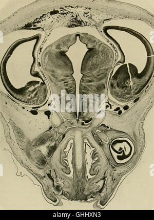 A 1904 German scientific study on the development of the human brain ...