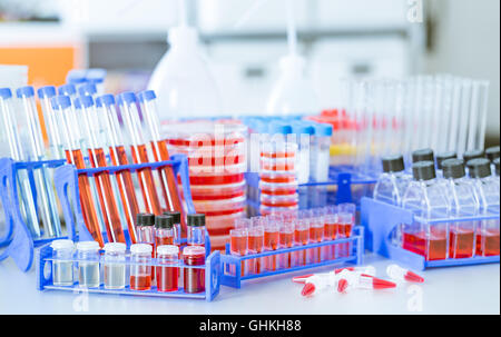 Test tubes and petri dishes with blood samples. DNA analysis concept ...