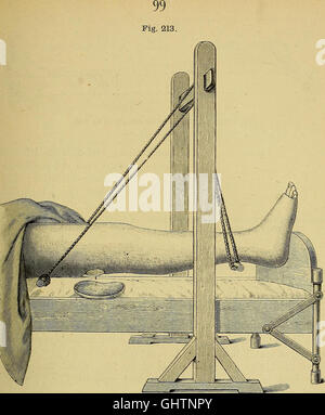 The surgeon's handbook on the treatment of wounded in war - a prize essay (1884)