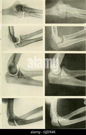 This 1915 work explores the therapeutic uses of radiography, X-rays ...