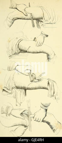 A surgical reference work from 1852, illustrated with over 1,900 ...