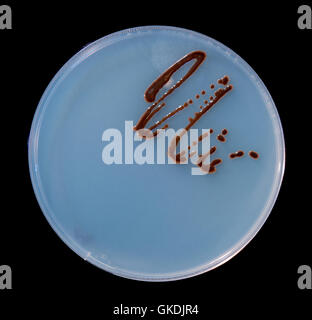 Petri dishes with colonies of microbes and spores of fungi Stock Photo