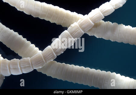 Tapeworm Taenia solium Portugal Stock Photo 115386554 