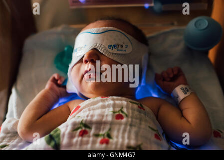 Newborn baby in hospital crib with phototherapy eye mask Stock Photo