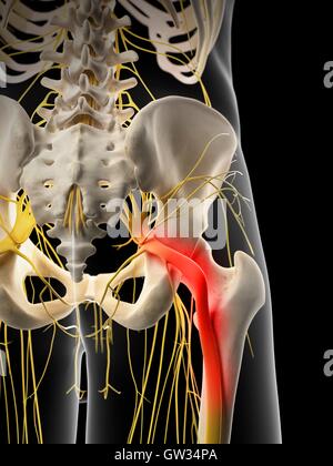 Human sciatic nerve pain, illustration. Stock Photo