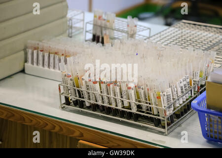 tubes prepared for centrifuge machine in hematology laboratory / blood tubes with labels in circular tray Stock Photo