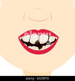 Child smiling and showing dirty, broken and decayed teeth. Close up in the mouth. Stock Vector