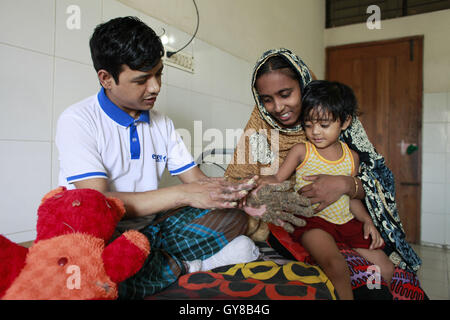 Dhaka, Bangladesh. 18th Sep, 2016. Tahera, 3, daughter of Abul Bajandar, touches her father's hand at a hospital bad in Dhaka, Bangladesh, September 18, 2016. Doctors carried out several operations to remove extremely rare epidermodysplasia verruciformis warts from his hands and legs. Abul, who was admitted to DMCH on January 30, has been suffering from an extremely rare genetic skin disease epidermodysplasia verruciformis, which is also referred to as 'Tree Man Disease.'' The disease is caused by a defect in the immune system. It causes abnormal susceptibility to human papilloma Stock Photo