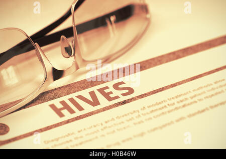 Hives. Medical Concept on Red Background. 3D Illustration. Stock Photo