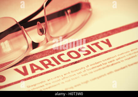 Diagnosis - Varicosity. Medicine Concept. 3D Illustration. Stock Photo