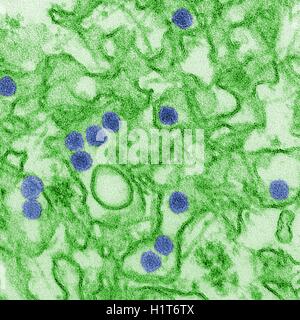 Zika virus. Coloured transmission electron micrograph (TEM). Stock Photo