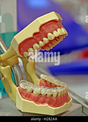 Artificial human jaw with teeth. Stock Photo