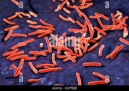 Tuberculosis bacteria. Computer artwork of Mycobacterium tuberculosis bacteria, the Gram-positive rod-shaped bacteria which cause the disease tuberculosis. Stock Photo