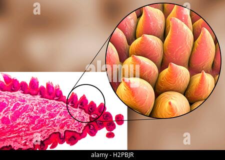Tongue surface, light micrograph and computer illustration. Filiform papillae (cone-shaped) on the surface of the tongue. Filiform papillae contain nerve endings that transmit tactile (touch) information to the brain. Stock Photo