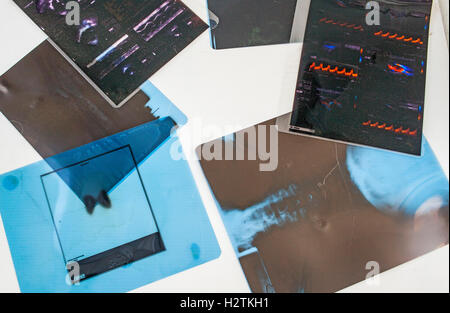 Radiography storage to recycle, recycling center Stock Photo