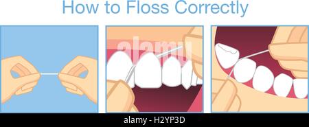 How to floss correctly for cleaning teeth Stock Vector